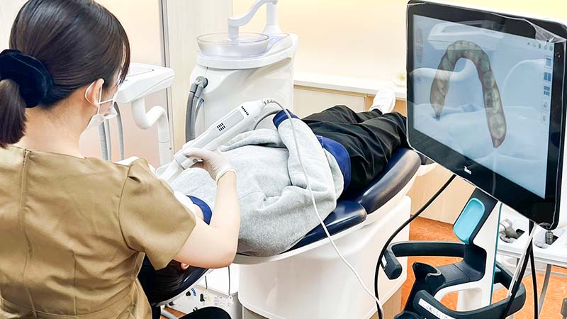 口腔内スキャン