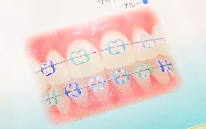 カラーゴムの組み合わせ例